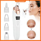 5 in 1 Electric Blackhead Remover Pore Cleaner Device